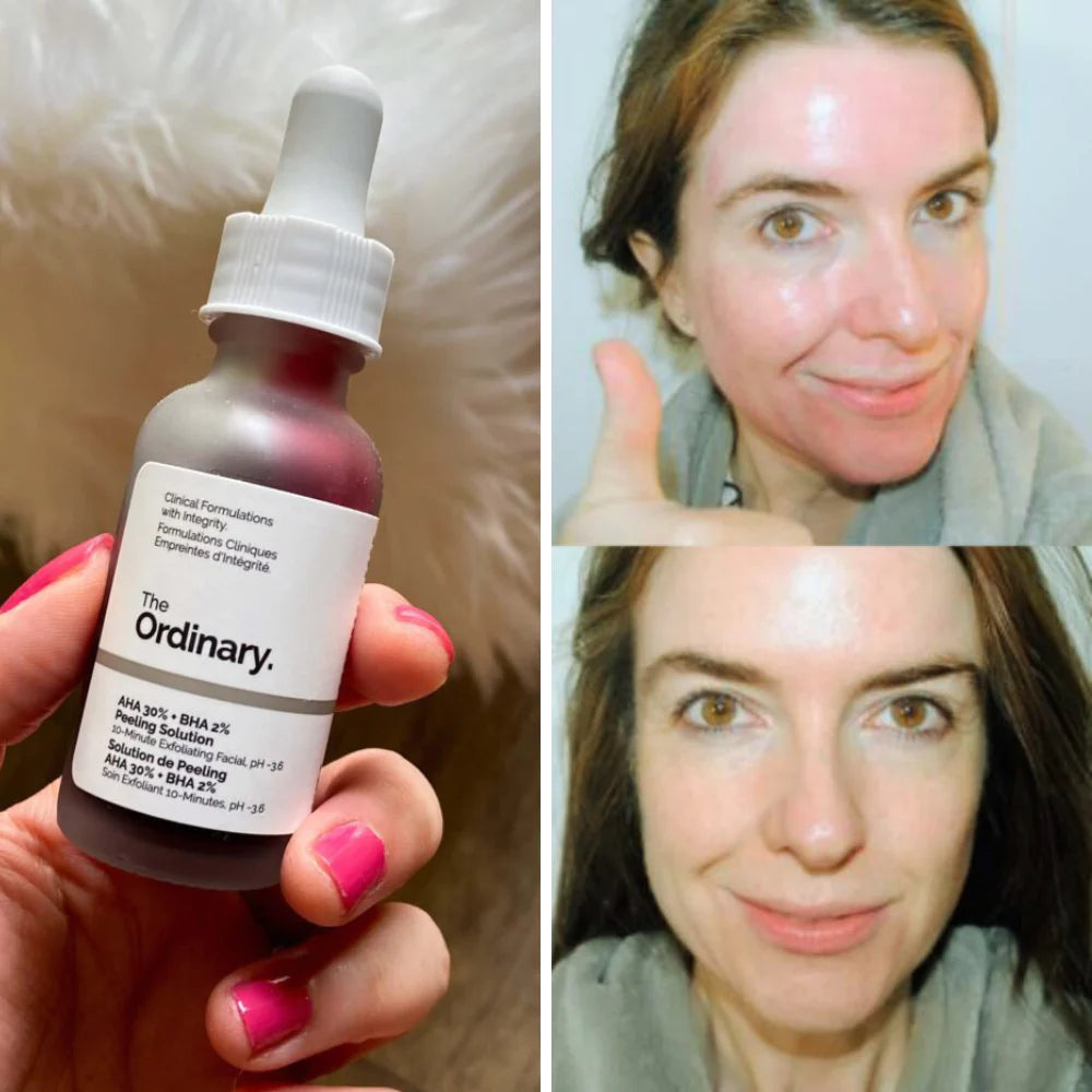 The Ordinary - AHA 30% + BHA 2% Peeling Solution - 30ml